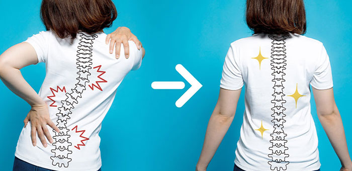 chiropractic for good posture in Monroeville, PA